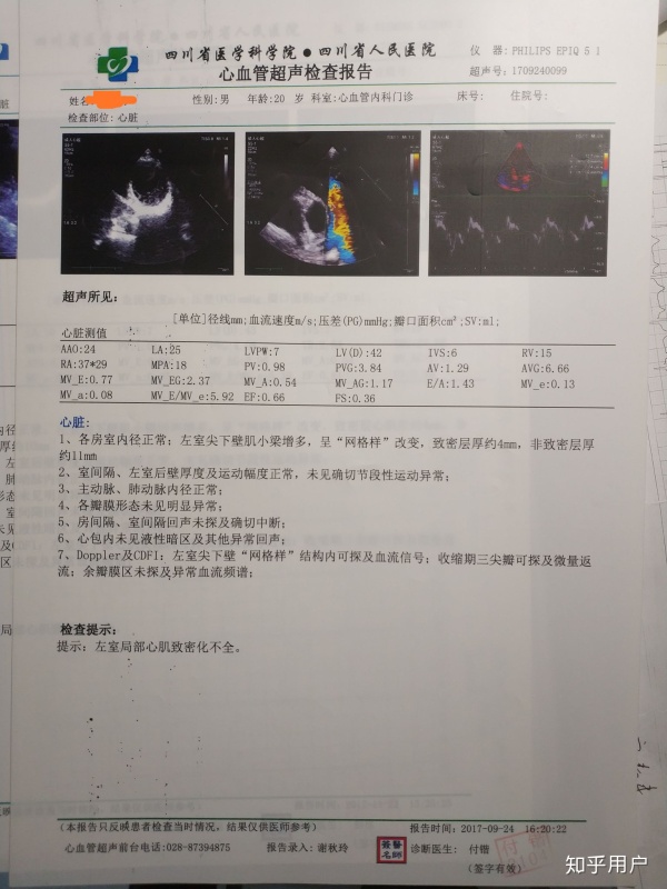 心肌致密化不全有办法治疗吗能活多久